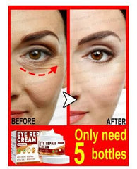 Eye Bags Removal Cream - Under Eye Cream