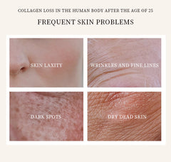 Collagen Crystal Mask Upper And Lower Segments